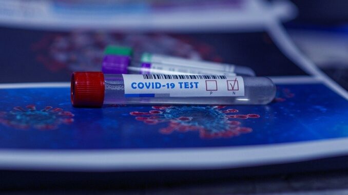 covid-19 test